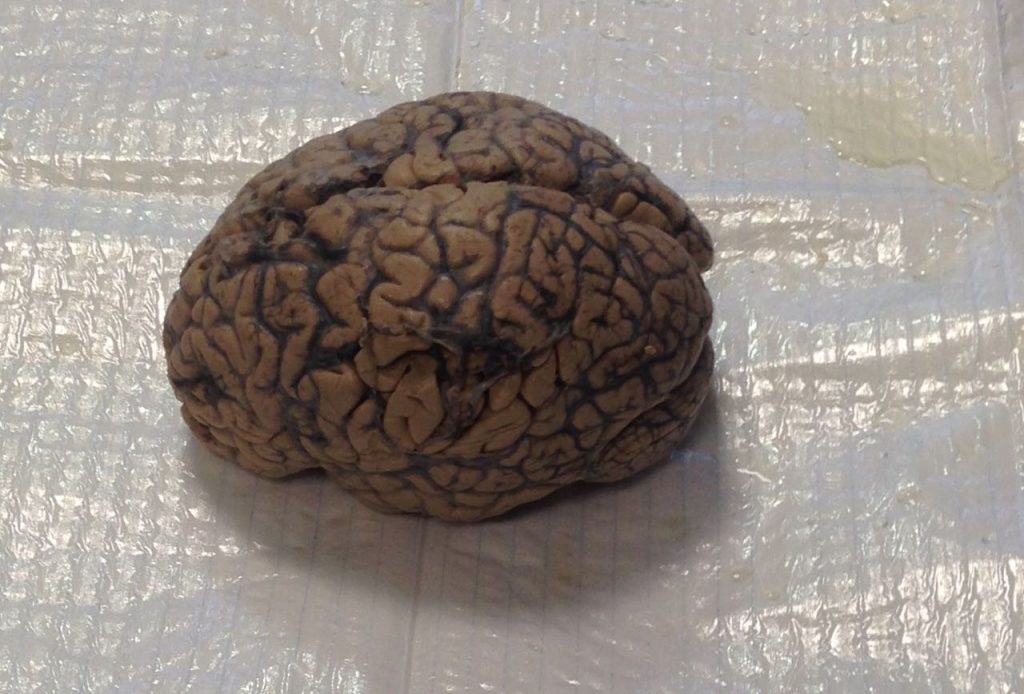 Ein Neurochirurg am CSG